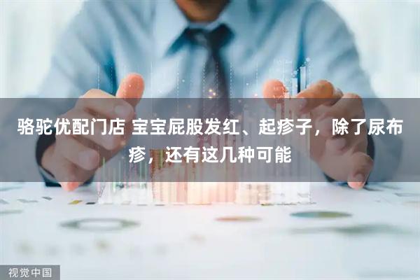 骆驼优配门店 宝宝屁股发红、起疹子，除了尿布疹，还有这几种可能